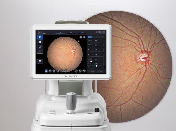 Fundus single macular level 4