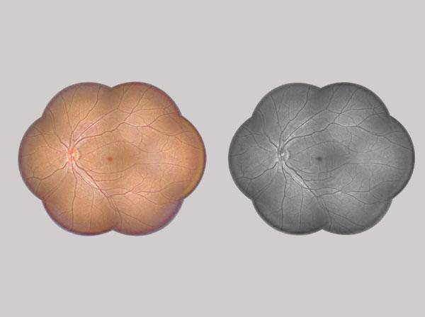 Fundus panorama level 4/Grey