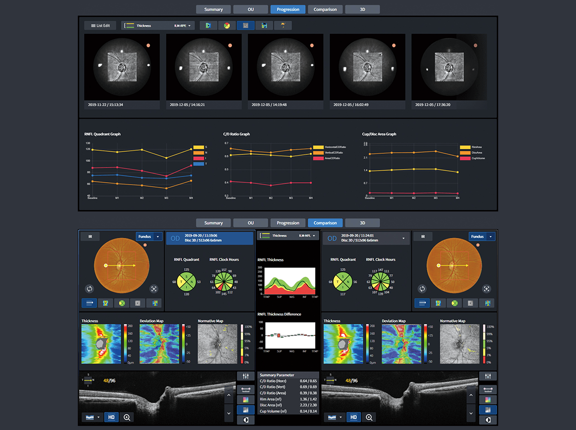 Optic Disc / Progression, Optic Disc / Compare