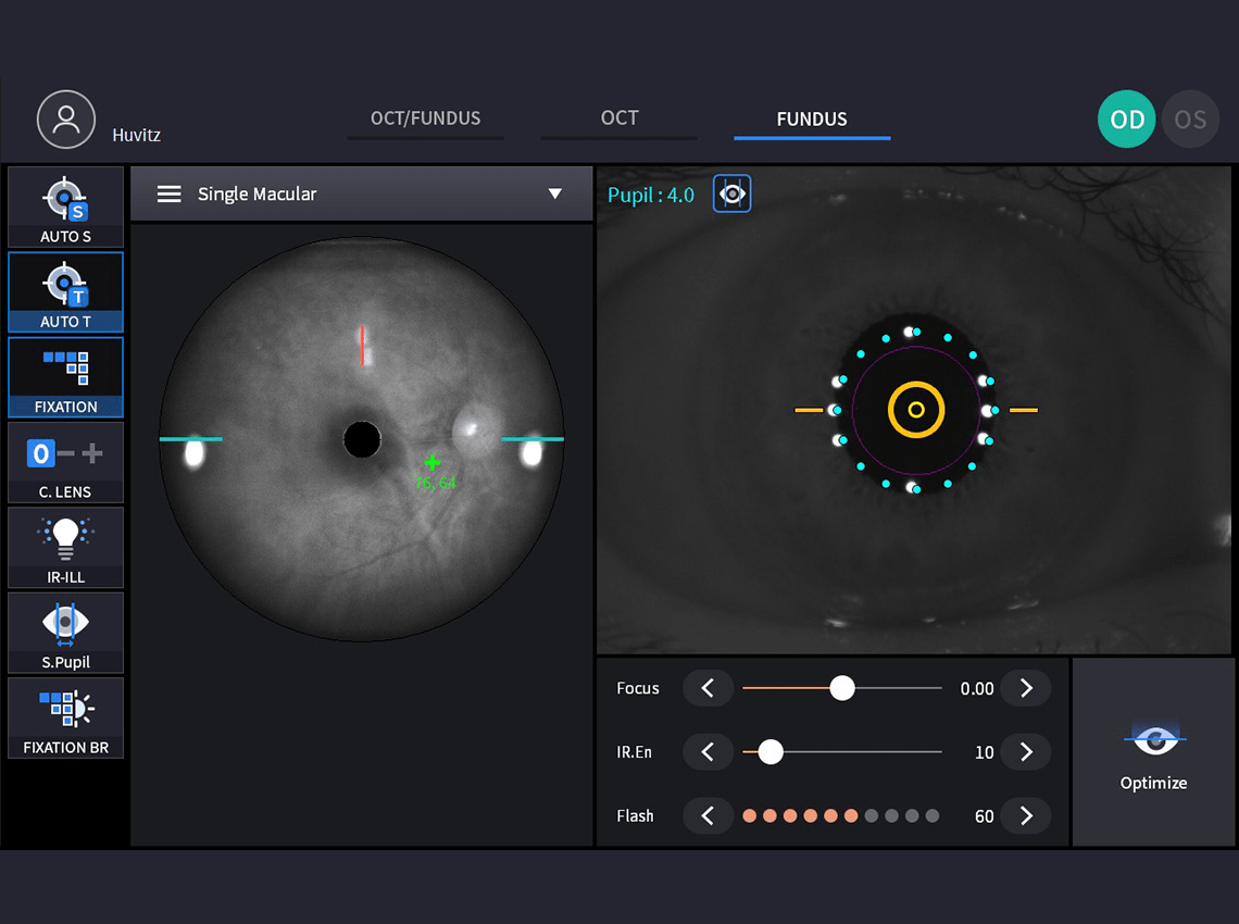 Screenshot of the fundus examination interface on the HFC-1