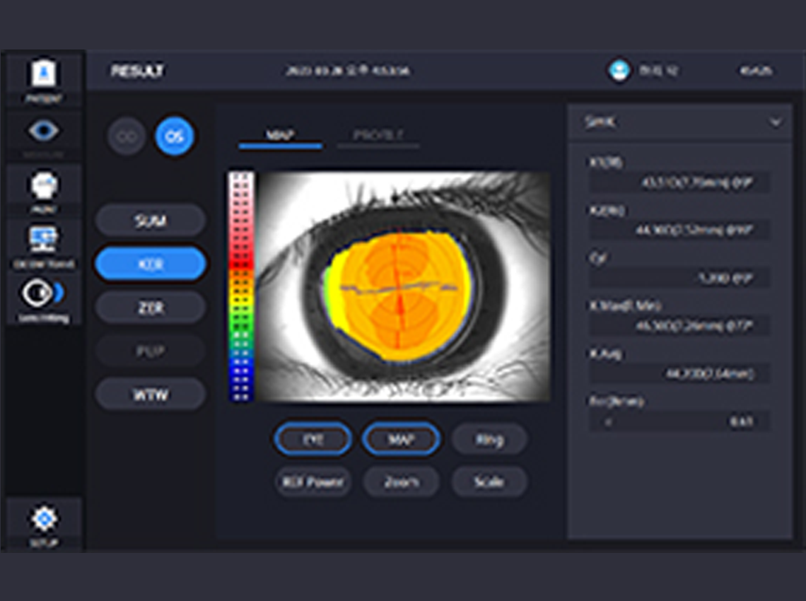 Map : Refractive Power