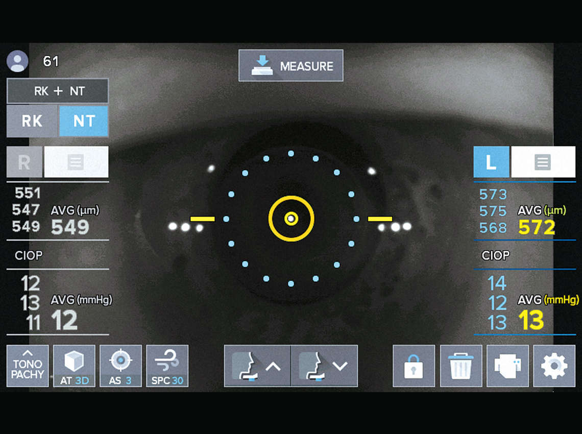 Peripheral Keratometry Measurement