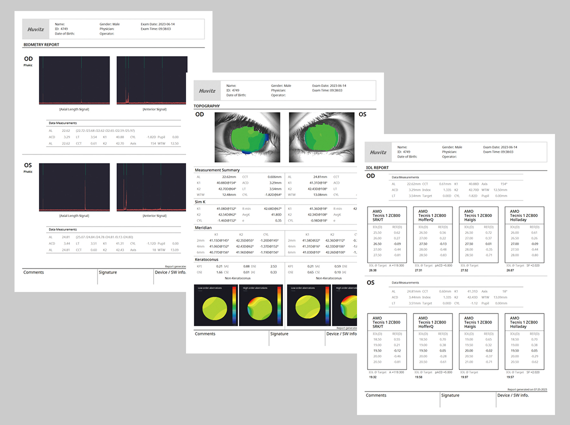 Report : Biometry, Topography, IOL