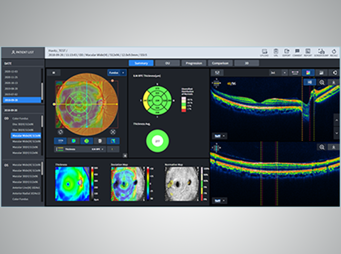 Macular