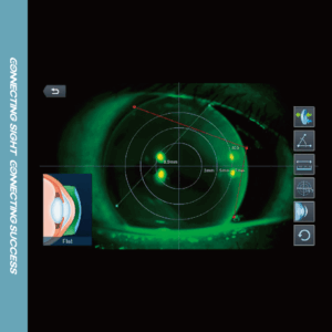 Contact lens fitting-assistance guide