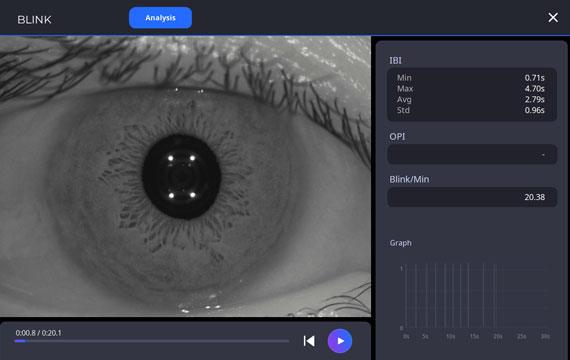Blink Analysis