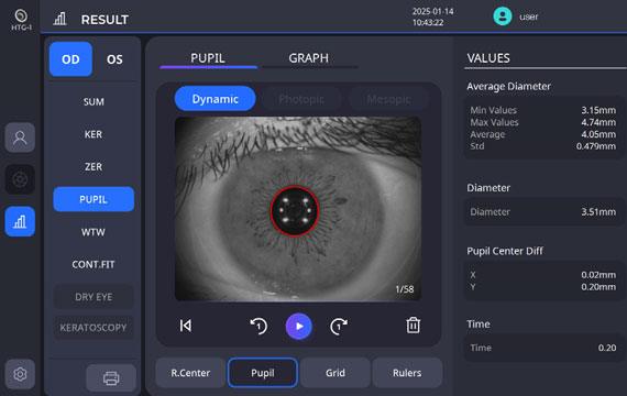 Pupillometry