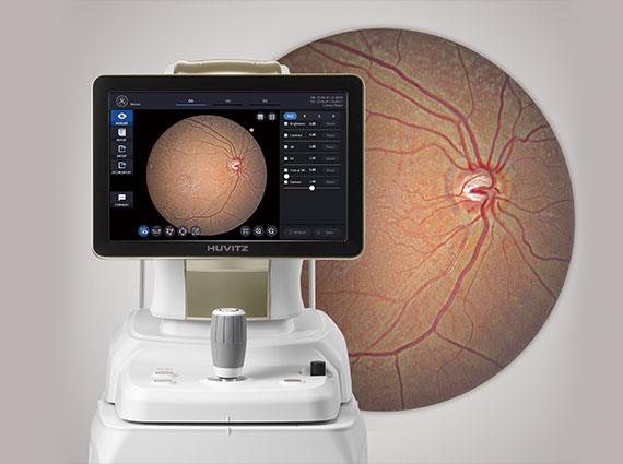 Fundus single macular level 4