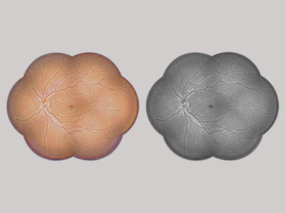 Fundus panorama level 4 Grey