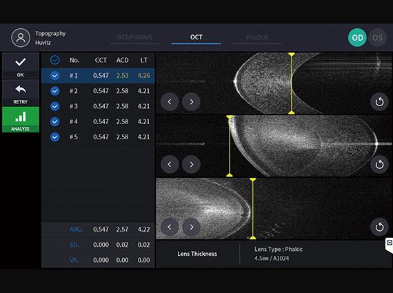 Biometry