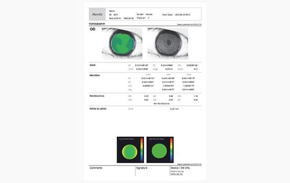 Report : Topography