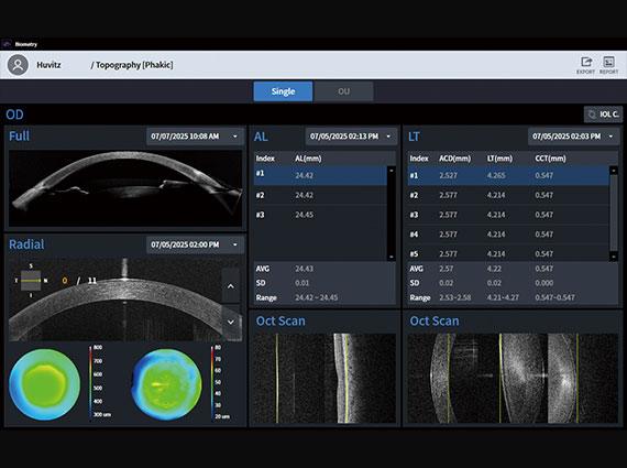 Biometry