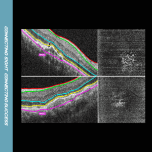 angiography