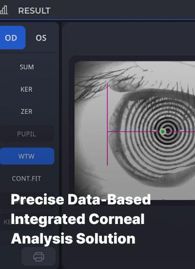 Precise Data-Based Integrated Corneal Analysis Solution
