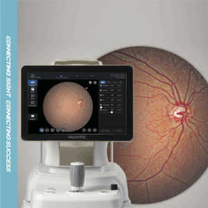 fundus camera