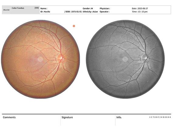 Fundus Image