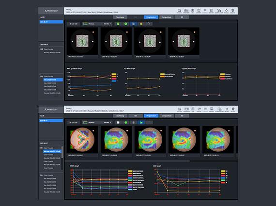 Disc 3D Progression