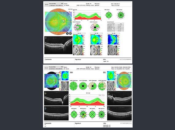 Macular Wide OCT + Fundus