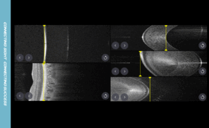 biometry