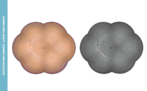 fundus panorama level4