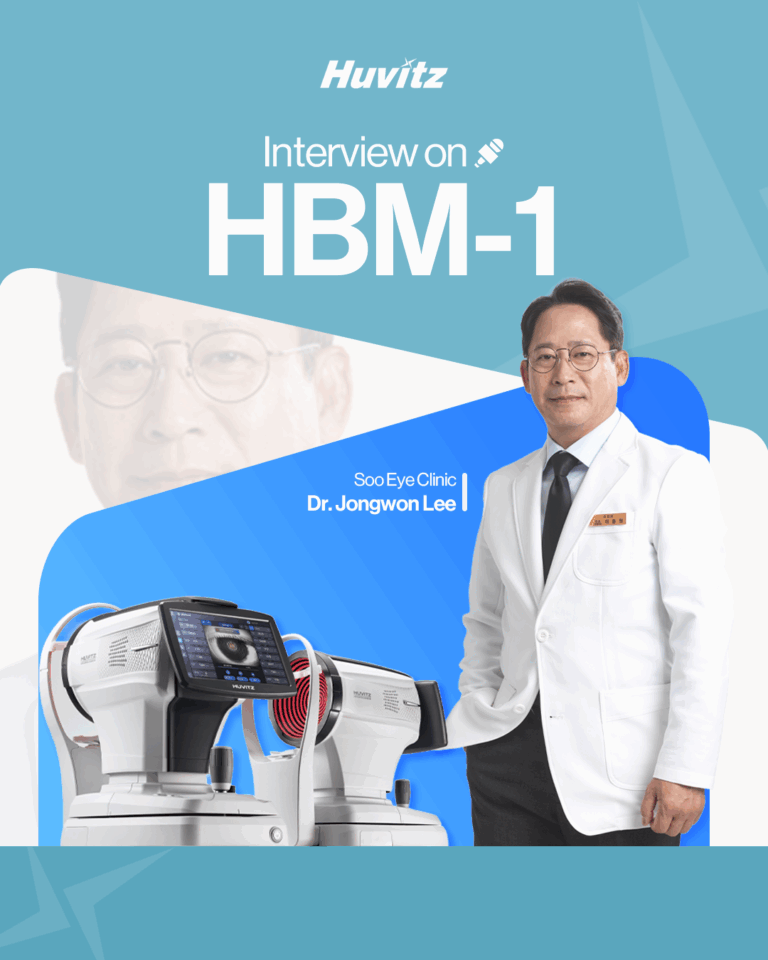 interview on HBM-1