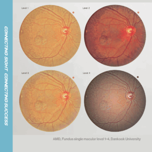 Advanced Fundus Imaging
