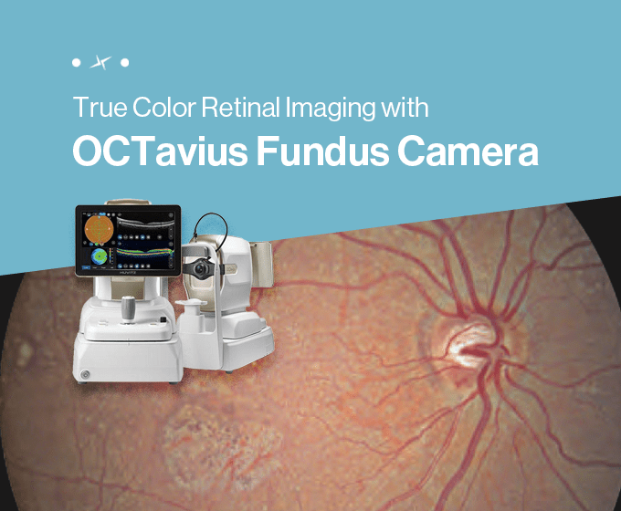 True Color Retinal Imaging with OCTavius Fundus Camera